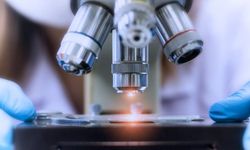 Türk bilim insanlarından akciğer kanserinde çığır açan çalışma: Radyoterapiye yanıt veren 12 gen tespit edildi