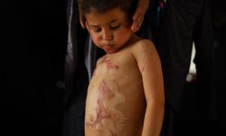 MSF’den Gazze Uyarısı: Tıbbi Malzemeler Tükenmek Üzere