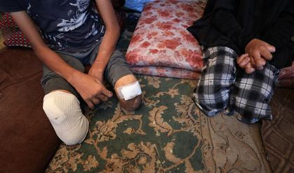 BM: Gazze’de 7 Ekim’den Bu Yana 4 Bin Çocuk Ampute Edildi