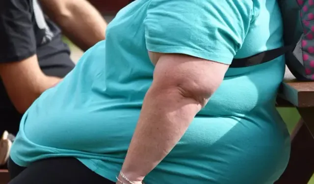 Sağlık Bakanlığı: 3 kişiden 1'i obez
