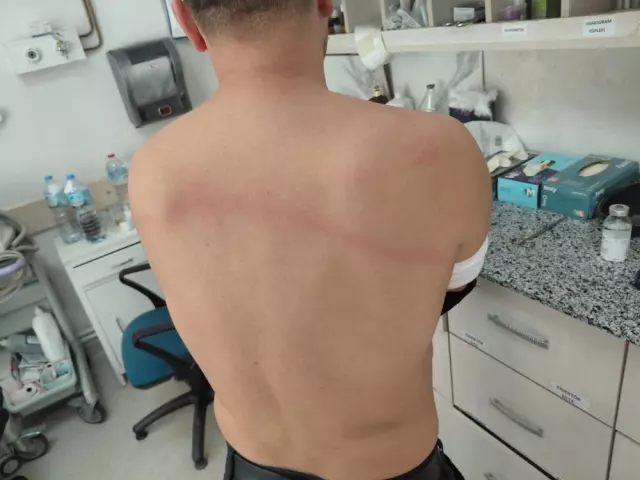 Chp Li Belediye Baskani Tas Dosemek Istemeyen 18993576 9869 M.jpg
